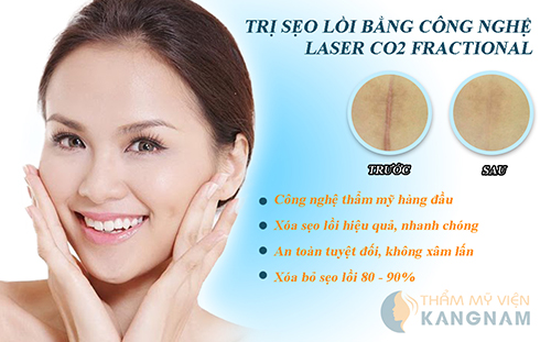 Kem trị sẹo lồi và những điều cần biết 5