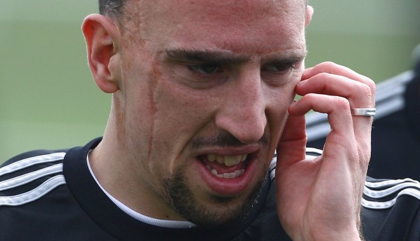 Ribery đã không đi xóa sẹo vì anh thất tự hào về vết sẹo ấy