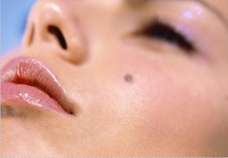 Cách chăm sóc da để phòng ngừa sẹo lõm sau tẩy nốt ruồi