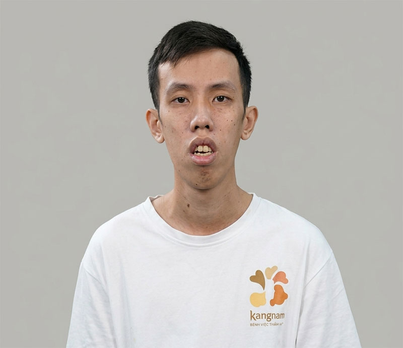 Hoàng Anh Đức thí sinh tham gia Hành trình Lột xác mùa 7