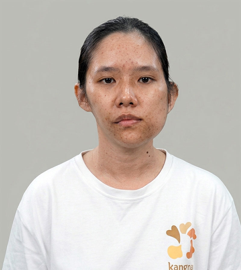 Bảo Ngọc thí sinh nhận được vé vàng phẫu thuật thẩm mỹ miễn phí