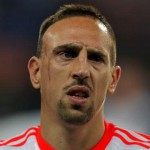Ribery đã quyết không xóa sẹo trên mặt